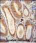 WFDC12 Antibody (C-term)